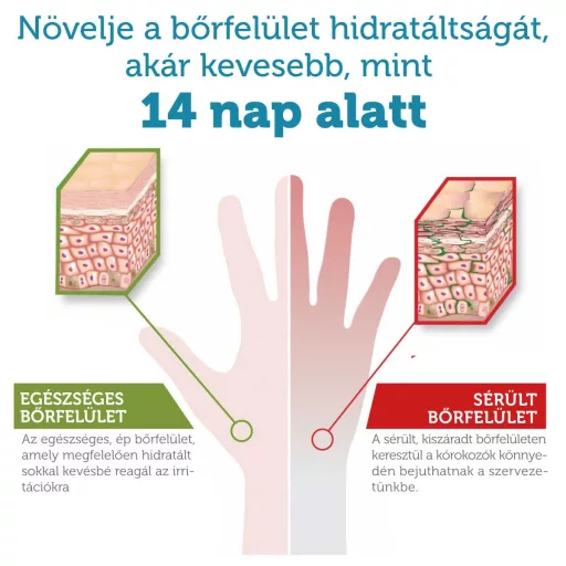 bőrhidratáltság HAND MEDIC által