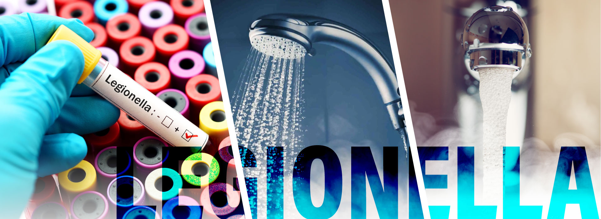 Legionella fertőzés