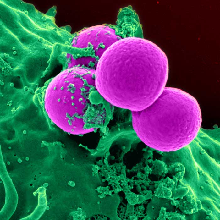 MRSA